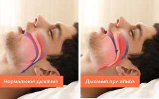 Постоянно холодно и хочется спать