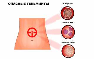 Анализы на глисты (гельминты, глистные инвазии, гельминтозы) у детей и взрослых, как и где сдать?