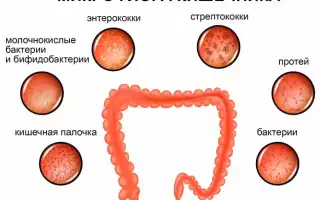 Симптомы дисбактериоза кишечника у взрослых