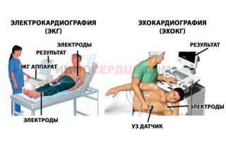 Транзиторная ишемическая атака последствия