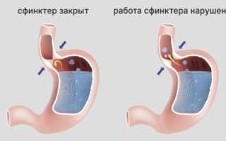 Заболевание эзофагит: что это такое?