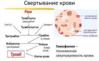 Плохая свертываемость крови что делать