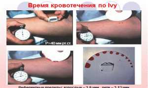 Определение длительности кровотечения