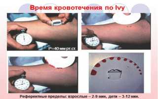 Определение длительности кровотечения