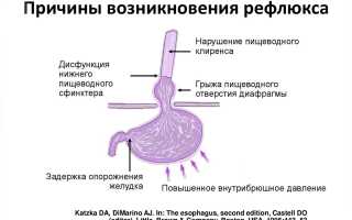 Причины эзофагита