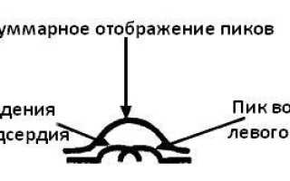 Как расшифровать результаты экг