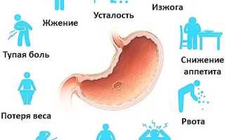 Симптомы опущения желудка и кишечника