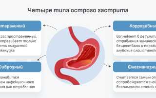 Методы комплексного лечения гастрита желудка, как правильно лечить?