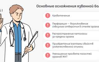 Что делать при язвенном кровотечении желудка: неотложная помощь, признаки, лечение, последствия