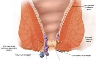 Со скольки лет появляется геморрой?