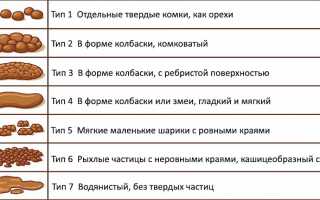 Как наладить стул при запорах и восстановить работу кишечника?