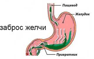 Гастрит и желчный пузырь