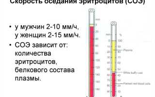 Количество соэ в крови норма