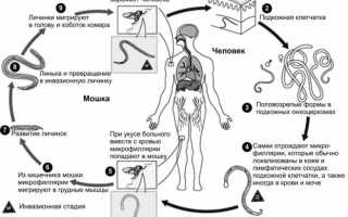 Симптомы, диагностика и лечение онхоцеркоза (онхоцерка, филярии) у человека