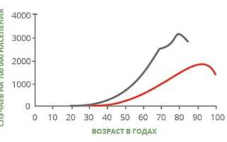 Рак желудка: возраст и статистика