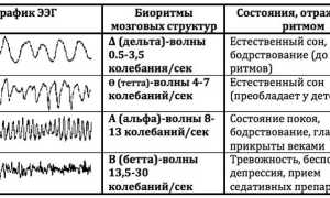 Что проверяет энцефалограмма головного мозга