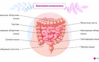 Очаговый сигмоидит