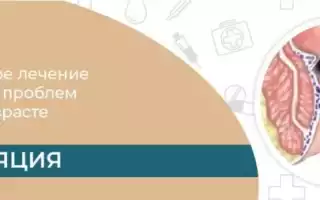 Лечение внутренних геморроидальных узлов методом коагуляции – лазерной, инфракрасной, биполярной