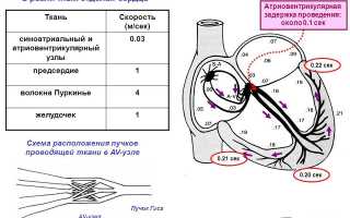 Атриовентрикулярная задержка причины