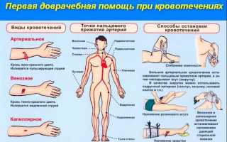 Что нужно делать при кровотечении