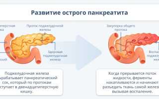 Какие уколы назначают при панкреатите от поджелудочной железы?