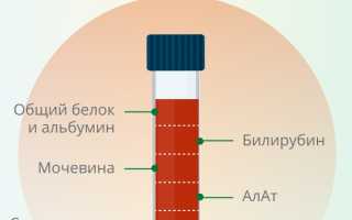 Анализы при раке желудка: гемоглобин, СОЭ и другие показатели