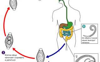 Власоглавы – возбудители трихоцефалеза, пути заражения, симптомы и лечение заболевания у детей и взрослых