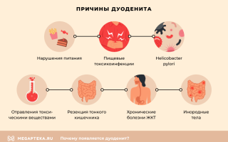 Симптомы катарального дуоденита