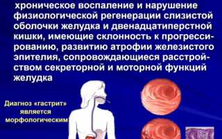 Гастродуоденит и рефлюкс-эзофагит: симптоматика и терапия