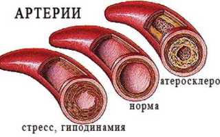 Тромбокрит выше нормы у женщин