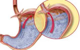 Дуоденит недостаточность кардии