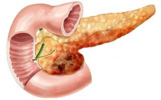 Уменьшение размеров поджелудочной железы, причины этого, как уменьшить?