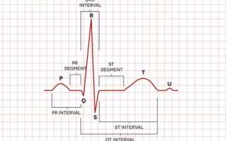 Расшифровка электрокардиограмма сердца