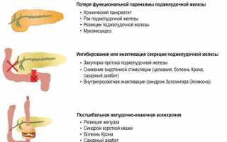 Нарушение внутренней секреции поджелудочной железы, внешнесекреторной, эндокринной функции