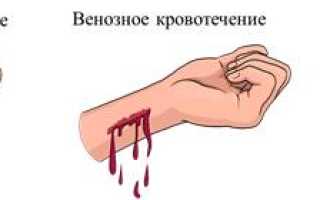 Правильный способ остановки капиллярного кровотечения кратко