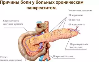 Алкогольный хронический панкреатит