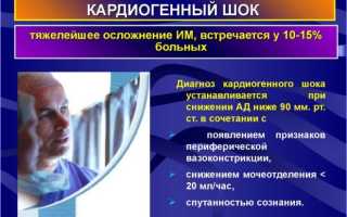 Кардиогенный шок классификация
