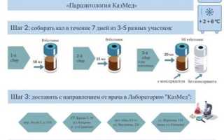 Как правильно сдавать анализ кала на глисты (гельминтоз) и простейшие?