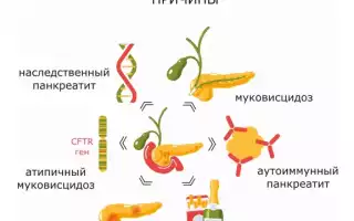 Хронический панкреатит – патогенез, этиология, причины возникновения