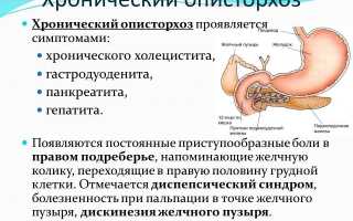 Острый описторхоз