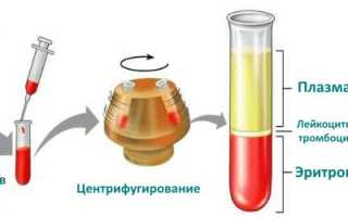 Гематокрит инвитро