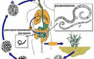 Схема лечения глистов (гельминтов гельминтоза, глистной инвазии) у взрослых