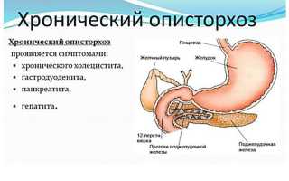 Заболевание описторхоз у взослого человека