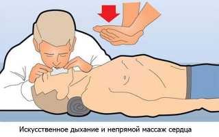 Непрямой массаж сердца показания к проведению