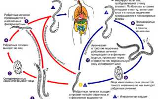 Причины стронгилоидоза, заражение и жизненный цикл строингилоидов