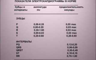 Экг расшифровка для студентов примеры