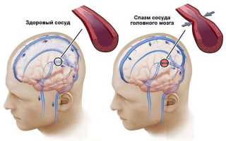 Запор, головокружение и болит голова