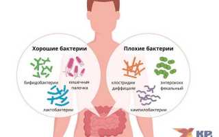 Чем опасен дисбактериоз кишечника?