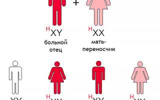 Гемофилия что это за болезнь у детей