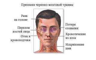 Чмт что это за диагноз